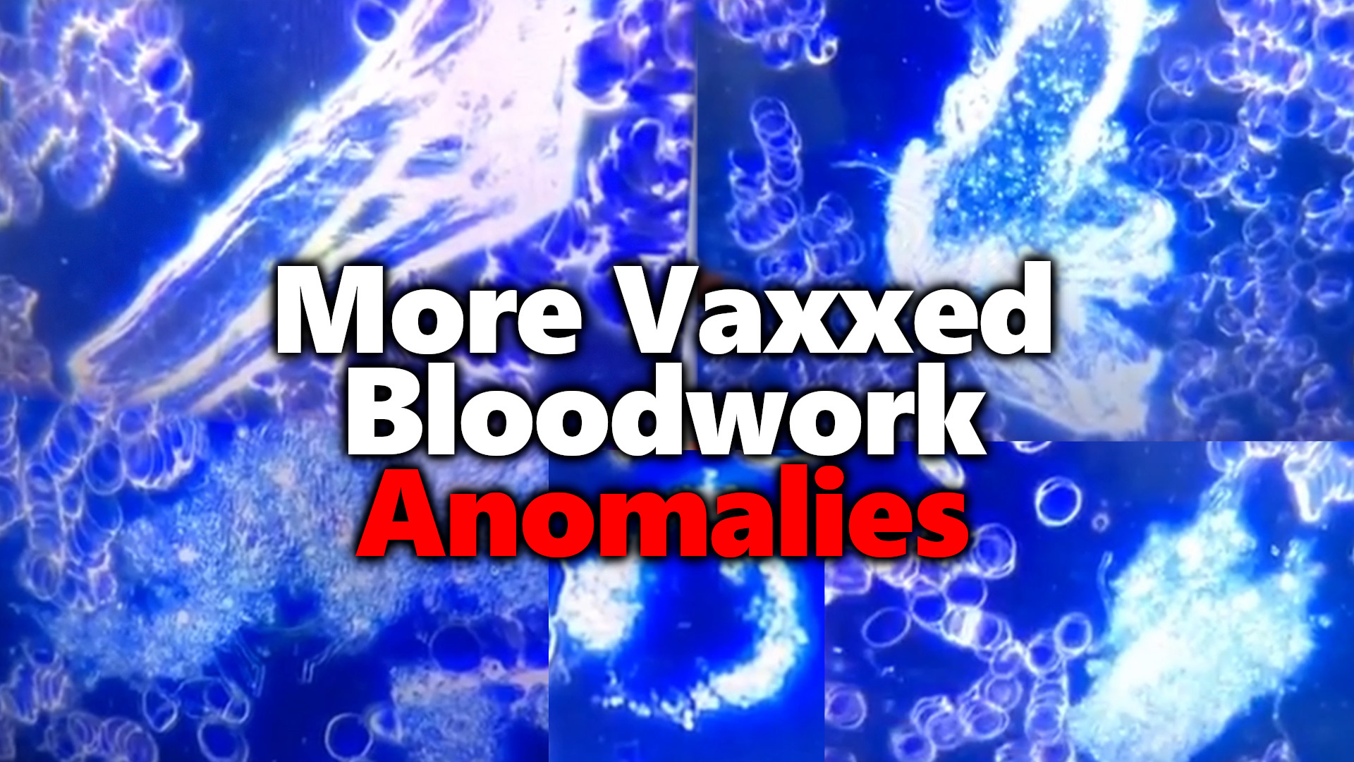 More #ClotShot Bloodwork Analysis: Another Doctor Blows Whistle On Post-Vaccine Anomalies & Mystery Objects